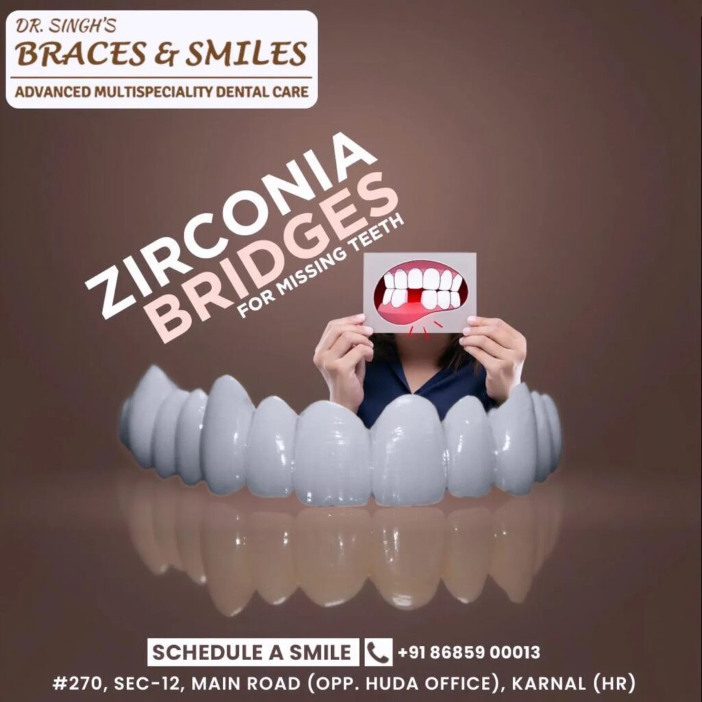 Dentures & Bridges - Best Dentist in Karnal