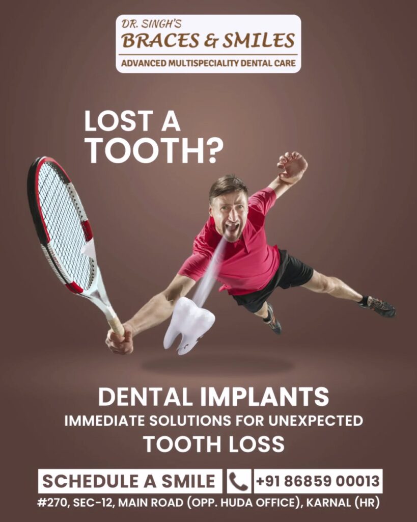 Dental Implant - Best Dentist in Karnal