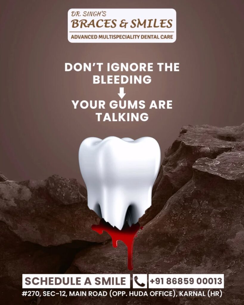 Gum Disease Treatment & Scaling - Best Dentist in Karnal