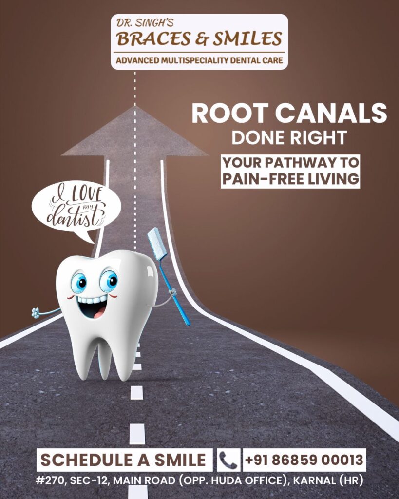 Root Canal Treatment | Best Dentist in Karnal